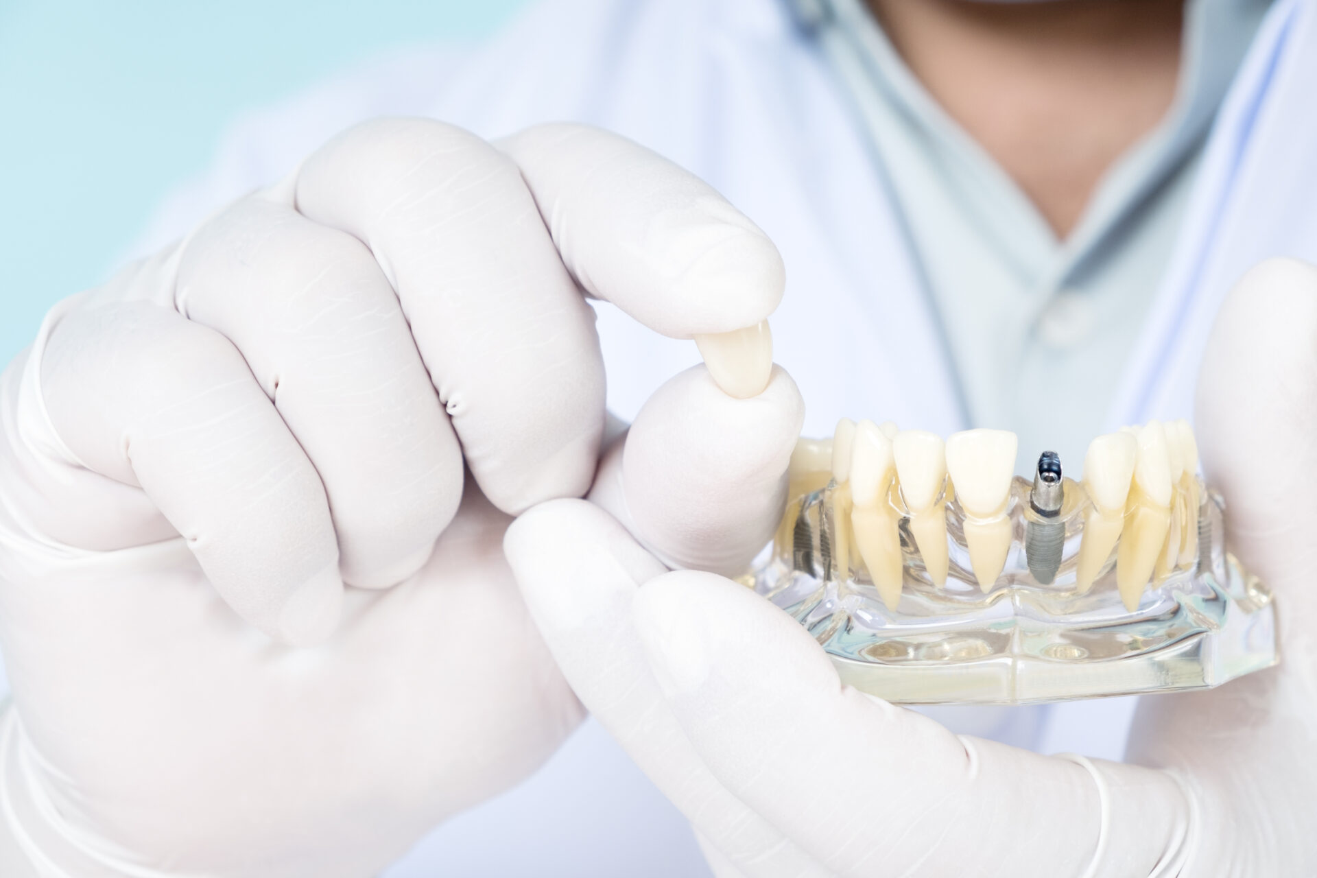 インプラントの模型を持って歯を前に出す男性歯科医師